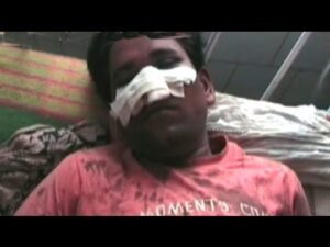 लड़की भगाने के चक्कर में, कटी युवक की नाक